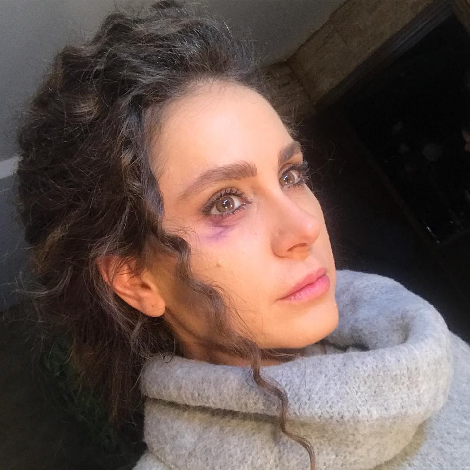 ديمة قندلفت تتعرض للضرب