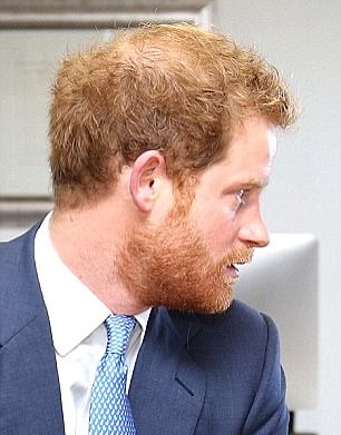 الأمير هاري يكافح الصلع بالمكملات الغذائية