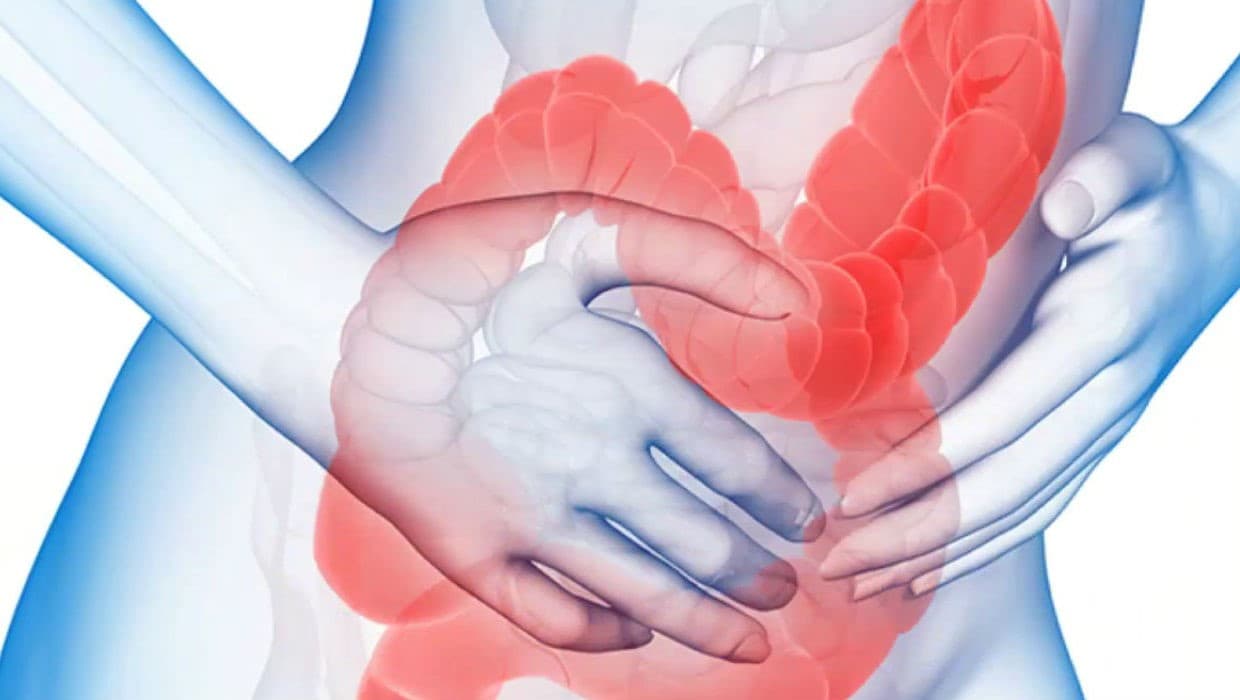 اعراض التهاب القولون التقرحي واهم اسبابه