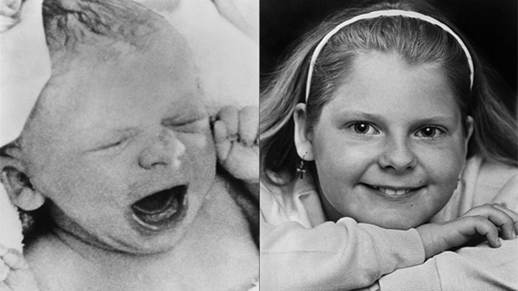 من-هو-أول-طفل-انابيب-في-العالم-؟- (1)