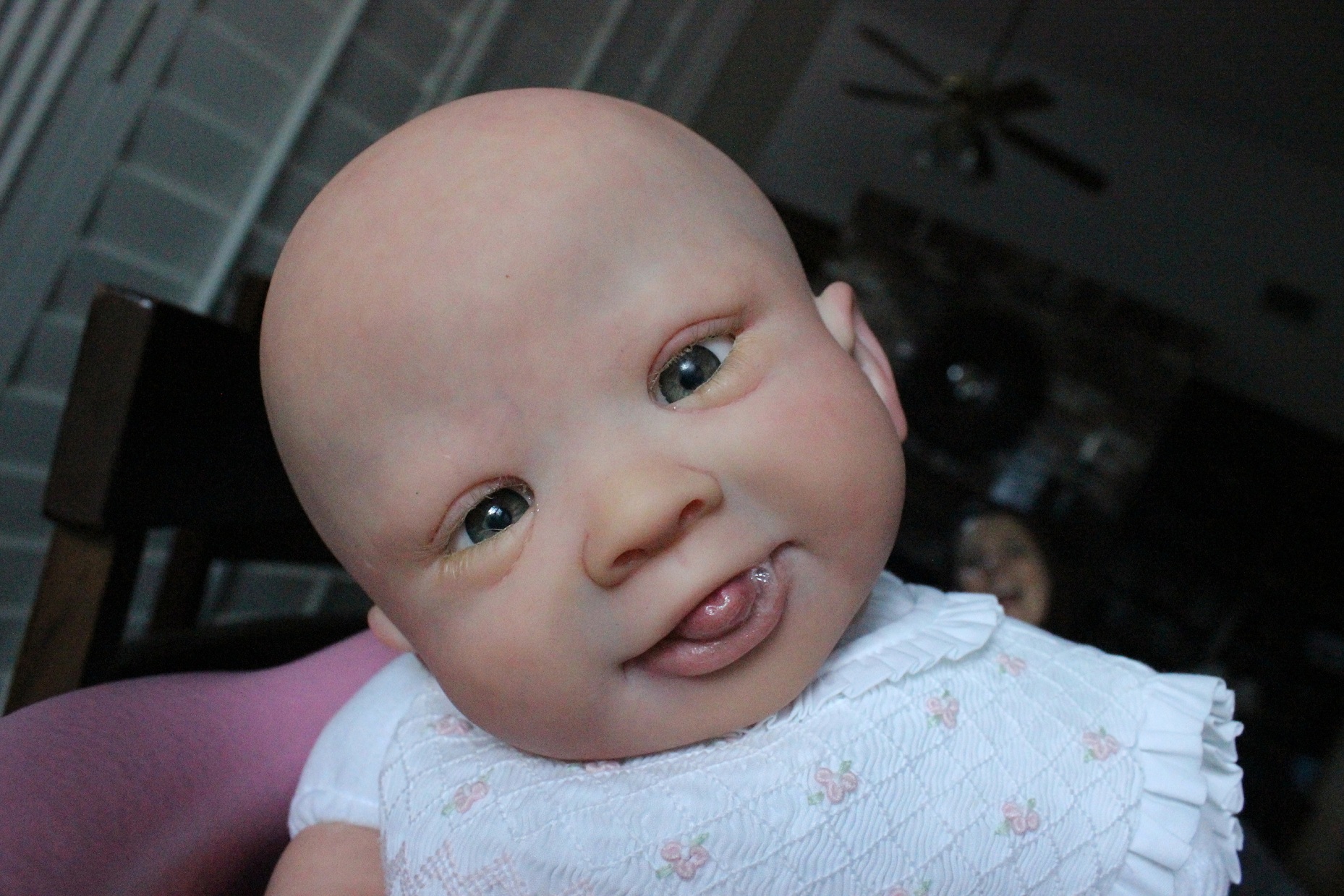 متلازمة داون