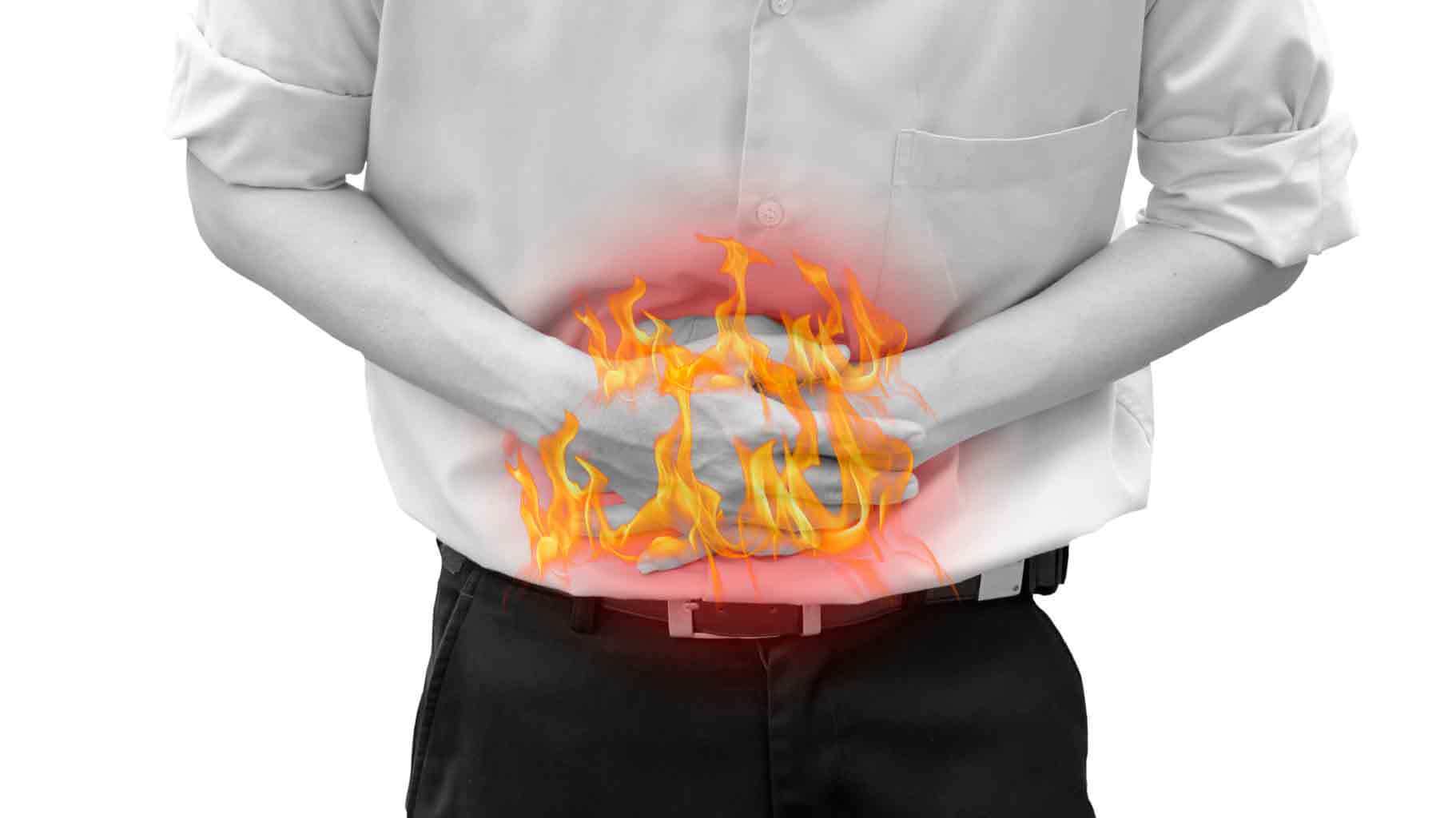 علاج حموضة المعدة
