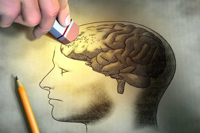 علامات الاصابة بالزهايمر