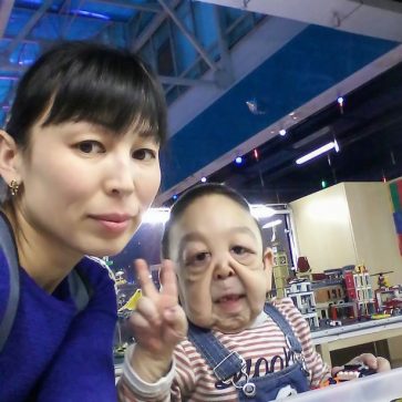 مرض نادر يحول طفل إلى رجل ستيني عجوز