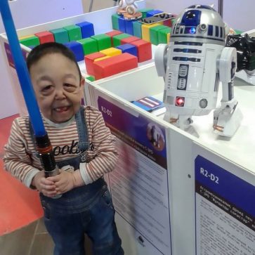 مرض نادر يحول طفل إلى رجل ستيني عجوز