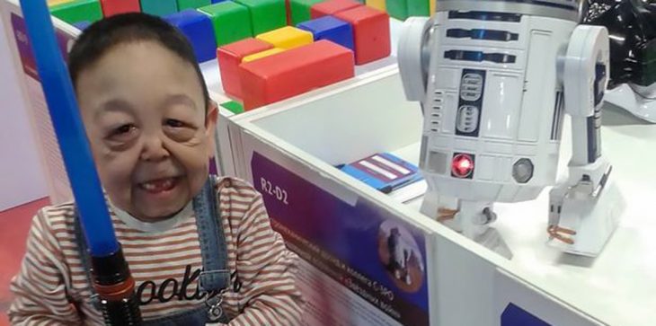 مرض نادر يحول طفل إلى رجل ستيني عجوز