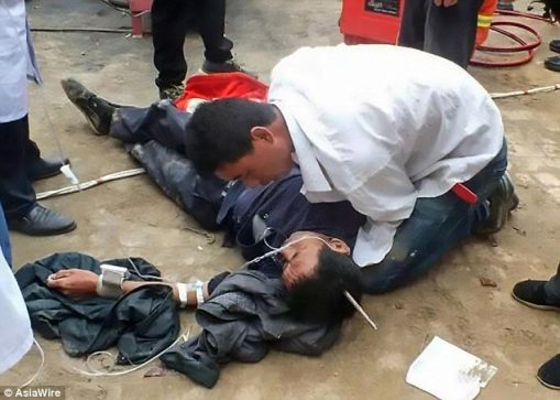 بالصور نجاة عامل صيني بعد اختراق سيخ حديدي لجمجمته