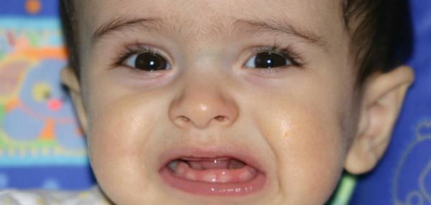 امراض الاسنان عند الرضع