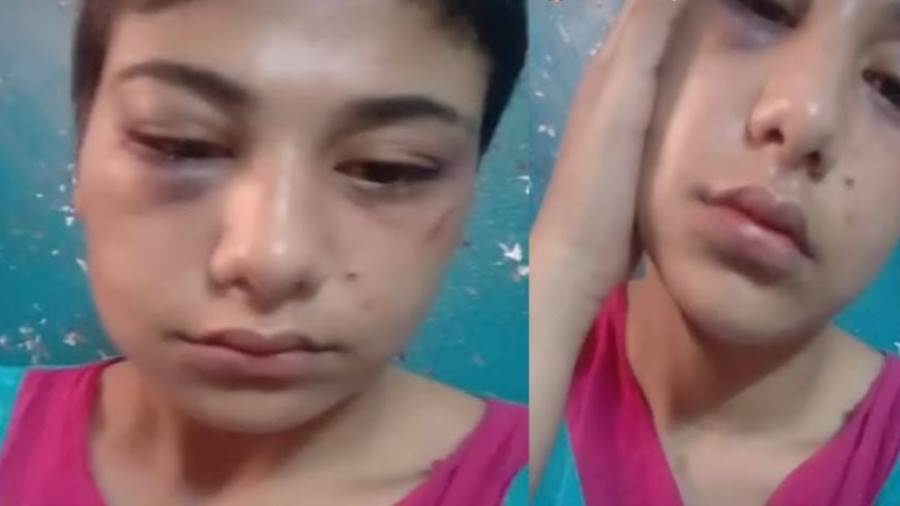 المتهم باغتصاب منة عبد العزيز يعترف أنها ليست بكرا