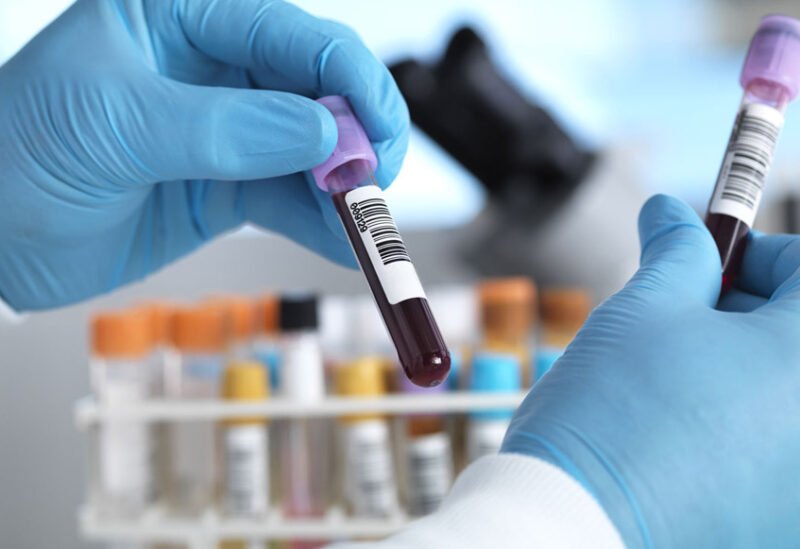 اختبار دم جديد يكشف 50 نوعا من السرطان