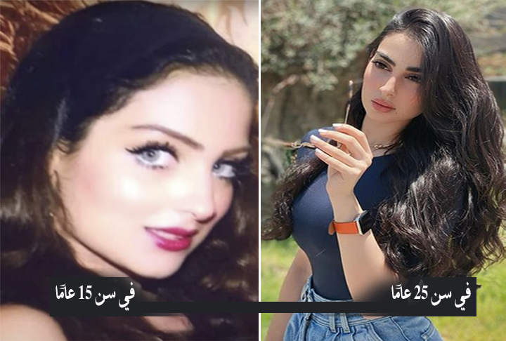 زينب العلوان قبل عملية التجميل