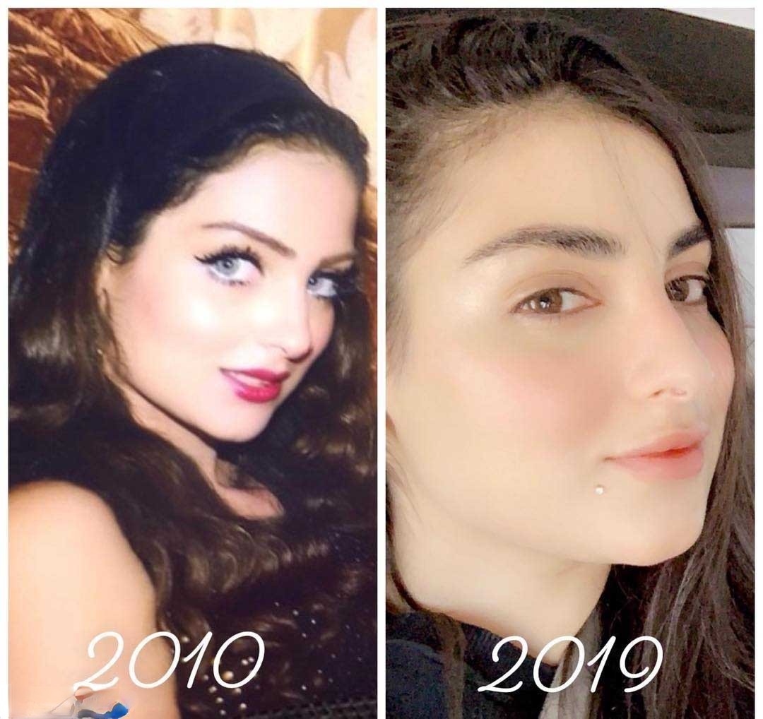 زينب العلوان قبل عملية التجميل