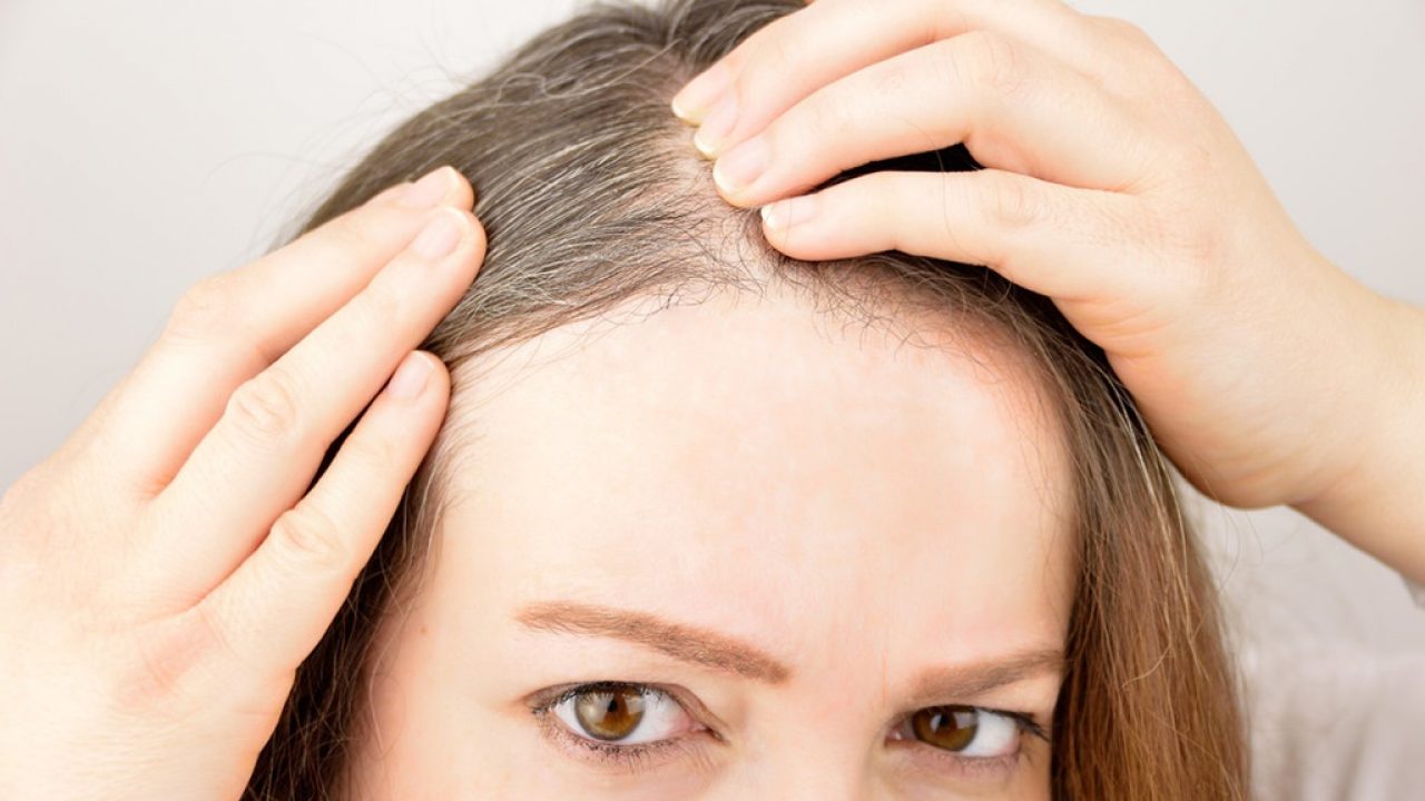 طرق طبيعية لعلاج الشعر المتساقط