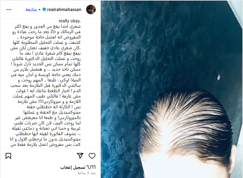 تساقط شعرها من الجذور رحمة حسن تكشف عن حالتها النفسية بسبب عيادة تجميل بالزمالك