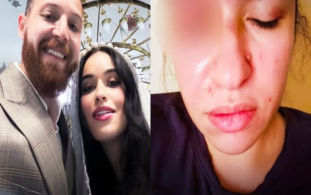 زوجة الفنان محمود حجازي تتهمه بضربها وسحلها وإصابتها بكدمات متفرقة في جسدها