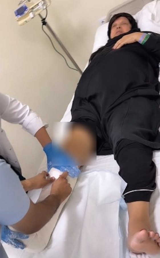 فيفي عبده تتعرض لكسر في الساق بعد سقوطها داخل منزلها